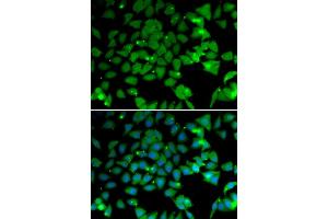 Immunofluorescence analysis of U2OS cells using N antibody (ABIN6129932, ABIN6144318, ABIN6144319 and ABIN6222781). (NAA10 antibody  (AA 161-235))
