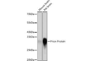Western blot analysis of extracts of various cell lines, using Prion Protein Rabbit mAb (ABIN7269517) at 1:1000 dilution. (PRNP antibody)