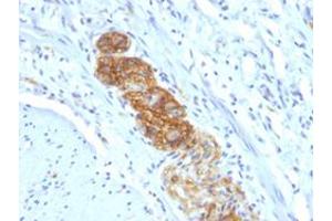 Immunohistochemical staining (Formalin-fixed paraffin-embedded sections) of human colon with NCAM1 monoclonal antibody, clone NCAM1/784 . (CD56 antibody)