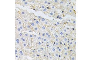 Immunohistochemistry of paraffin-embedded mouse liver using IGF1R antibody (ABIN5970073) at dilution of 1/100 (40x lens). (IGF1R antibody  (N-Term))