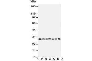Western blot testing of Kallikrein-11 antibody and Lane 1:  U87;  2: A549; 3: HeLa;  4: MM231;  5: MM453;  6: COLO320;  7: Jurkat cell lysate.