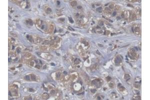 Immunohistochemistry (IHC) image for anti-Eukaryotic Translation Elongation Factor 2 (EEF2) (AA 32-233) antibody (ABIN7444787)