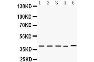 Western Blotting (WB) image for anti-Doublesex and Mab-3 Related Transcription Factor 1 (DMRT1) (AA 98-128), (N-Term) antibody (ABIN3043450)