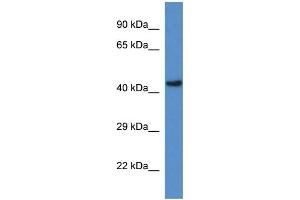 WB Suggested Anti-Gcdh Antibody   Titration: 1.