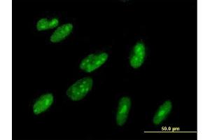 Immunofluorescence of purified MaxPab antibody to ZBTB22 on HepG2 cell. (ZBTB22 antibody  (AA 1-634))