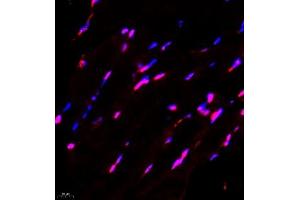 anti-TLS/FUS antibody