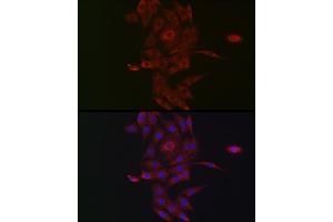 Immunofluorescence analysis of PC-12 cells using NRP2 Rabbit pAb (ABIN3016282, ABIN3016283, ABIN3016284, ABIN1681113 and ABIN6219689) at dilution of 1:50 (40x lens). (NRP2 antibody  (AA 150-420))
