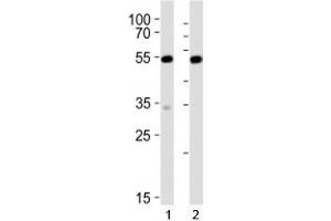 Western blot analysis of lysate from 1) mouse NIH3T3 and 2) rat C6 cell line using Srf antibody at 1:1000.