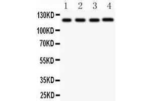 Observed bind size: 118KD (NLRP3 antibody  (AA 21-194))