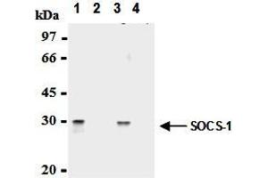 Immunoprecipitation of SOCS-1 from mouse splenocytes and mouse thymocytes with AM26561AF-N (1,3) or mouse IgG1 (2,4).
