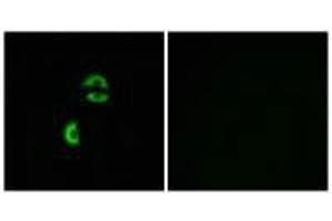 Immunofluorescence analysis of A549 cells, using LDLRAD3 antibody.