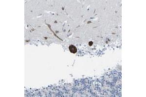 Immunohistochemical staining of human cerebellum with PDZK1IP1 polyclonal antibody  shows strong cytoplasmic positivity in purkinje cells.