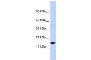 Image no. 1 for anti-Tumor Protein D52-Like 3 (TPD52L3) (AA 71-120) antibody (ABIN6744307) (TPD52L3 antibody  (AA 71-120))