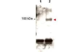 Western blot using  Protein A purified anti-Stat1 pY701 antibody shows detection of phosphorylated Stat1 (indicated by arrowhead at ~91 kDa) in K562 cells after 30 min treatment with 1Ku of hIFN-? (STAT1 antibody  (pTyr701))
