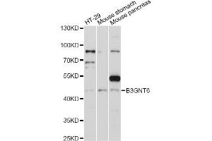 Western blot analysis of extracts of various cell lines, using B3GNT6 antibody (ABIN6292802) at 1:1000 dilution. (B3GNT6 antibody)