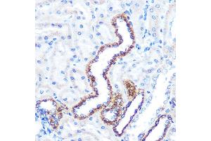 Immunohistochemistry of paraffin-embedded rat kidney using  Rabbit mAb (ABIN7265589) at dilution of 1:100 (40x lens). (Angiopoietin 2 antibody)