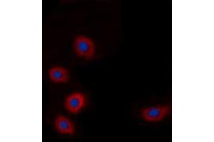 Immunofluorescent analysis of BRP44L staining in A549 cells. (BRP44L antibody  (N-Term))