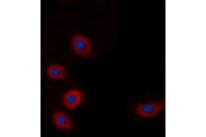 Immunofluorescent analysis of BRP44L staining in A549 cells.