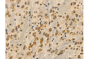 ABIN6258427 and ABIN6275063 at 1/100 staining Mouse brain tissue by IHC-P. (DMGDH antibody  (C-Term))