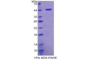 SDS-PAGE (SDS) image for Angiotensin I Converting Enzyme 2 (ACE2) (AA 93-464) protein (His tag) (ABIN1525351)