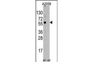 Western blot analysis of anti-ST13 Antibody pre-incubated with and without blocking peptide (BP6247a) in A2058 cell line lysate. (HSC70 Interacting Protein HIP antibody  (AA 50-80))