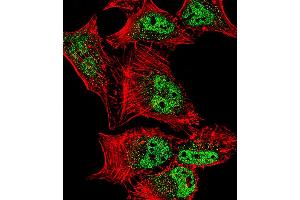 Fluorescent confocal image of Hela cell stained with MEF2C Antibody (S387).