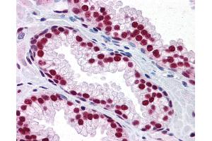 Anti-SAFB antibody IHC of human prostate. (SAFB antibody  (AA 111-201))