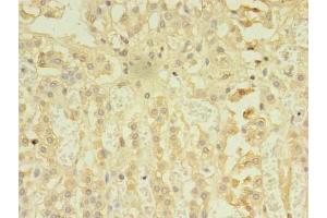 Immunohistochemistry of paraffin-embedded human adrenal gland tissue using ABIN7167480 at dilution of 1:100 (RIPK3 antibody  (AA 1-518))