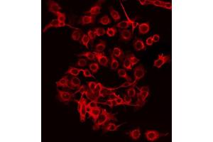 Immunofluorescence (fixed cells) (IF/ICC) image for anti-ATP-Binding Cassette, Sub-Family F (GCN20), Member 2 (ABCF2) (Internal Region) antibody (ABIN6257923)