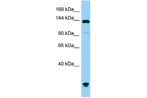 Host: Rabbit Target Name: Plcb1 Sample Type: Mouse Testis lysates Antibody Dilution: 1. (Phospholipase C beta 1 antibody  (C-Term))