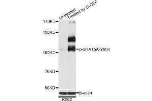 Western blot analysis of extracts of K562 cells, using Phospho-STAT5A-Y694 antibody (ABIN5969944) at 1/2000 dilution. (STAT5A antibody  (pTyr694))