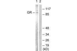Western blot analysis of extracts from Jurkat cells, treated with EGF (200 ng/mL, 15 mins), using GR (Ab-226) antibody. (Glucocorticoid Receptor antibody  (Ser226, Ser234, Ser246))