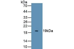 Detection of Recombinant ESM1, Human using Monoclonal Antibody to Endothelial Cell Specific Molecule 1 (ESM1) (ESM1 antibody  (AA 20-184))
