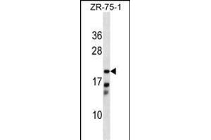 CBR4 antibody  (C-Term)