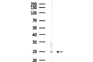 Western blot analysis of lysates from Rat testis, using C Antibody at 1/1000 dilution.