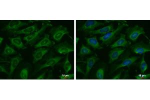 ICC/IF Image C9orf98 antibody [N3C3] detects C9orf98 protein at cytoplasm by immunofluorescent analysis. (AK8 antibody)