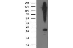Western Blotting (WB) image for anti-Synaptosomal-Associated Protein, 25kDa (SNAP25) antibody (ABIN1501016) (SNAP25 antibody)