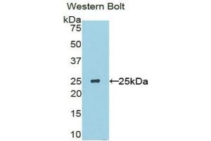 SOSTDC1 anticorps  (AA 24-206)