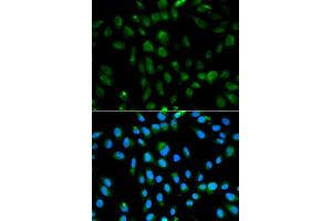 Immunofluorescence analysis of MCF-7 cells using PSMA3 antibody. (PSMA3 antibody)