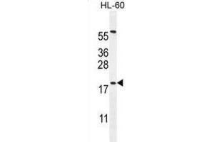 Western Blotting (WB) image for anti-Developmental Pluripotency Associated 5 (DPPA5) antibody (ABIN2996143)