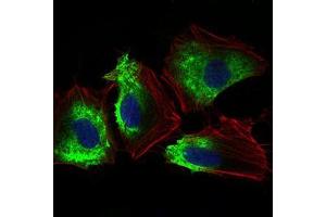 Immunofluorescence analysis of Hela cells using THY1 mouse mAb (green).