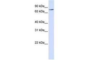 Image no. 1 for anti-Receptor-Interacting Serine-threonine Kinase 4 (RIPK4) (C-Term) antibody (ABIN6740940)