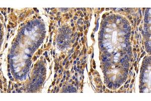 Immunohistochemistry (IHC) image for anti-Tumor Necrosis Factor alpha (TNF alpha) (AA 71-234) antibody (ABIN7430003)