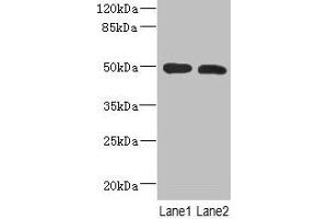 Western Blot All lanes: RGMA antibody at 12 μg/mL Lane 1: Mouse brain tissue Lane 2: Hela whole cell lysate Secondary Goat polyclonal to rabbit IgG at 1/10000 dilution Predicted band size: 50, 48, 51 kDa Observed band size: 50 kDa