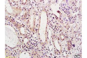 Formalin-fixed and paraffin embedded human kidney labeled with Anti-HNF1/TCF1/HNF1A Polyclonal Antibody, Unconjugated (ABIN686077) at 1:200 followed by conjugation to the secondary antibody and DAB staining. (HNF1A antibody  (AA 201-350))