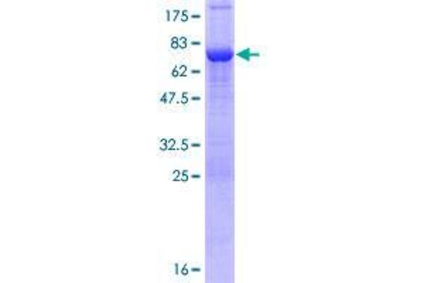 TBC1D16 Protein (AA 1-405) (GST tag)