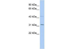 SIX Homeobox 1 antibody  (Middle Region)