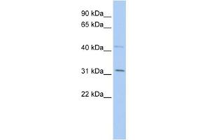 WB Suggested Anti-SIX1 Antibody Titration:  0.
