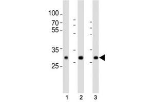 Western blot analysis of lysate from human (1) placenta, (2) lung, (3) kidney tissue lysate using SOD3 antibody at 1:1000. (SOD3 antibody  (C-Term))