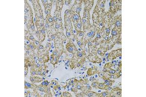 Immunohistochemistry of paraffin-embedded human liver injury using EPO antibody (ABIN5973306) (40x lens). (EPO antibody)